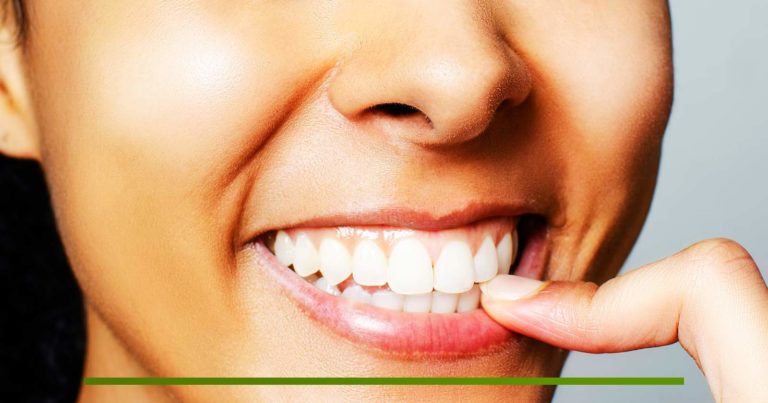 Beneficios de la estética dental