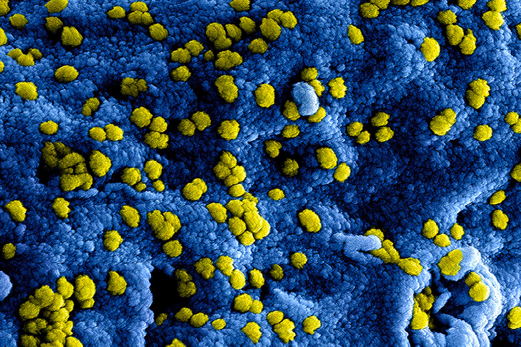 Infeccion Clamidia Embarazo